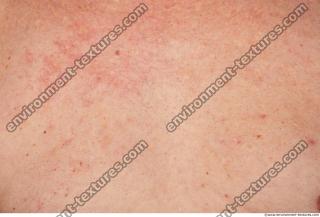 Photo Textures of Human Skin